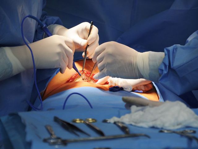 To w Polsce pierwsza taka operacja. Poznańscy lekarze odnieśli sukces na skalę światową