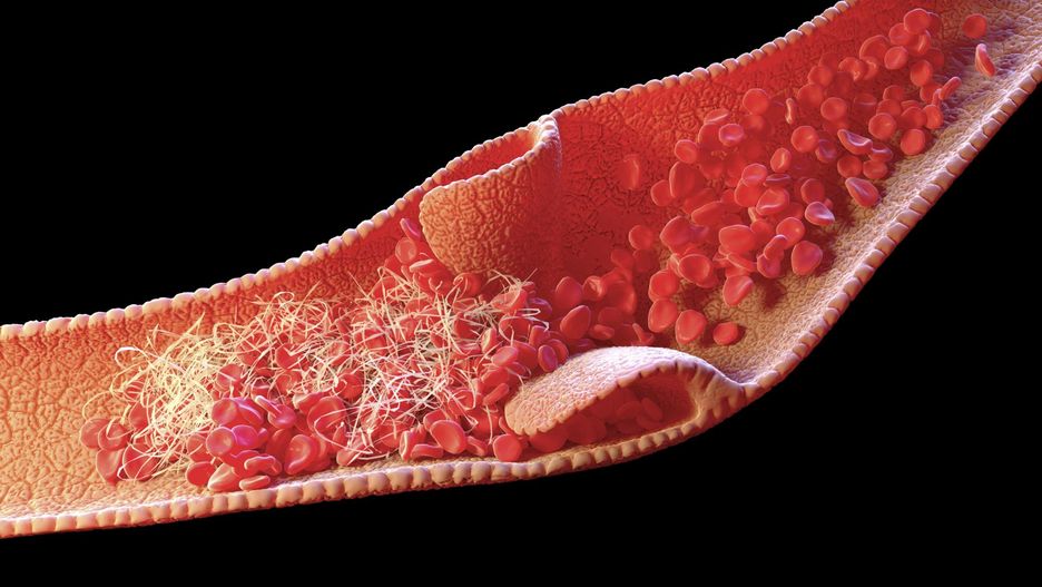 Koagulacja białek to między innymi proces krzepnięcia krwi