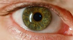 Choroby reumatyczne a oczy