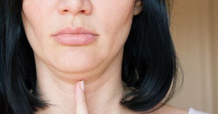 Lifting podbródka - charakterystyka zabiegu, wskazania, przeciwwskazania, cena, opinie