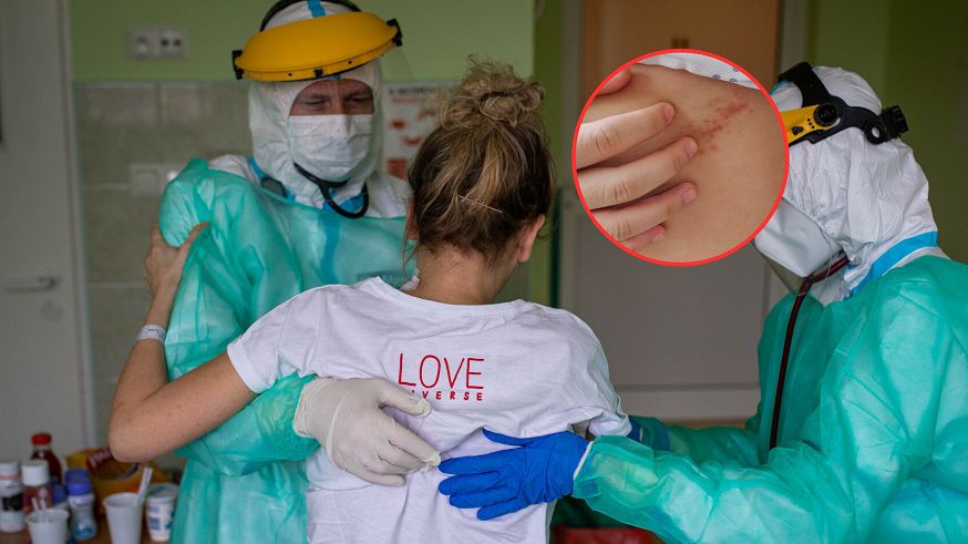 18-latka nie przeżyła. "Wstrząs bywa trudny do opanowania"