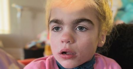 Pokazała zdjęcie córki. Dzięki temu 8 dzieci dostało właściwą diagnozę