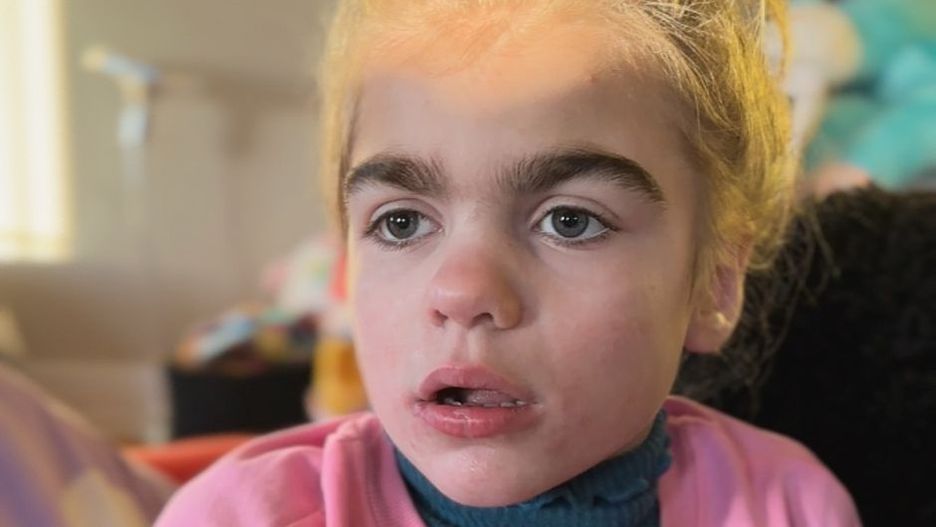 Pokazała zdjęcie córki. Dzięki temu 8 dzieci dostało właściwą diagnozę