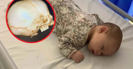 Niemowlę spadło ze stołu, gdy zmieniała jej pieluszkę. Dziewczynka złamała kość czaszki
