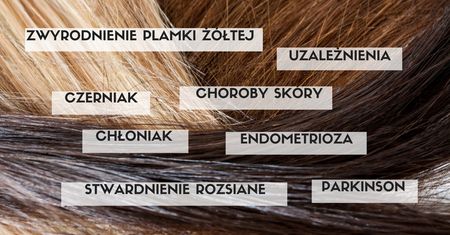 Co kolor włosów mówi o twoim zdrowiu?