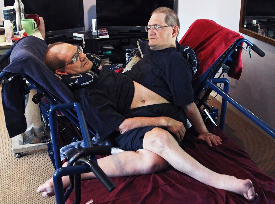 Najstarsi bracia syjamscy na świecie zmarli w wieku 68 lat. Od trzeciego roku życia występowali na festynach