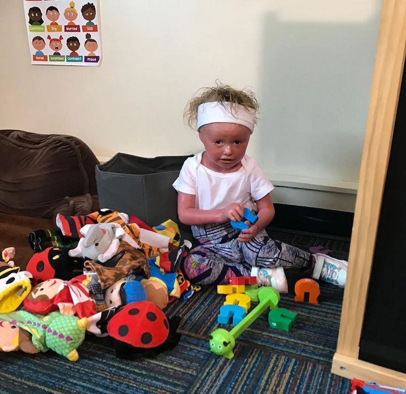 Anna lubi się bawić tak samo, jak inne dzieci (Instagram/harlequindiva)