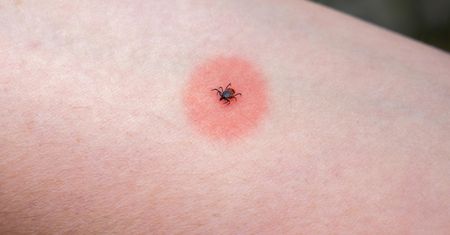 W tych regionach jest najwięcej kleszczy. Ukąszenie może wywołać alergię na mięso