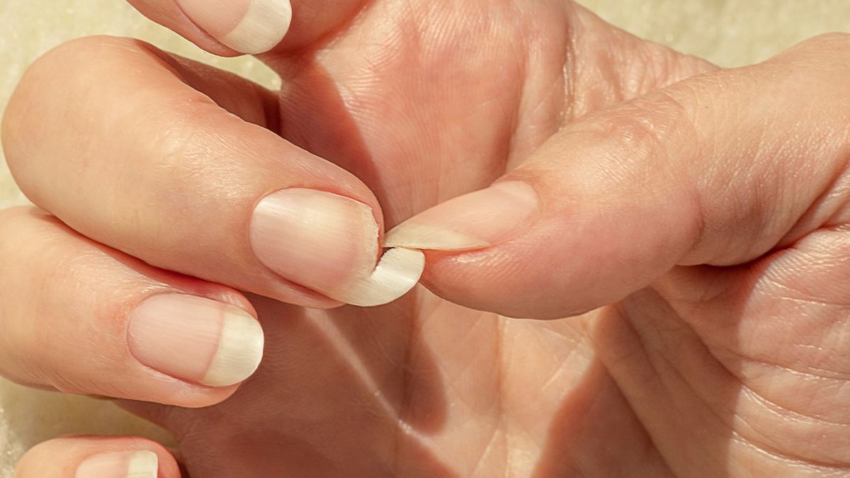 Pękające paznokcie mogą wynikać z nieprawidłowej stylizacji paznokci