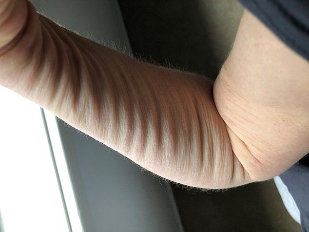 Skóra Claire się zmarszczyła