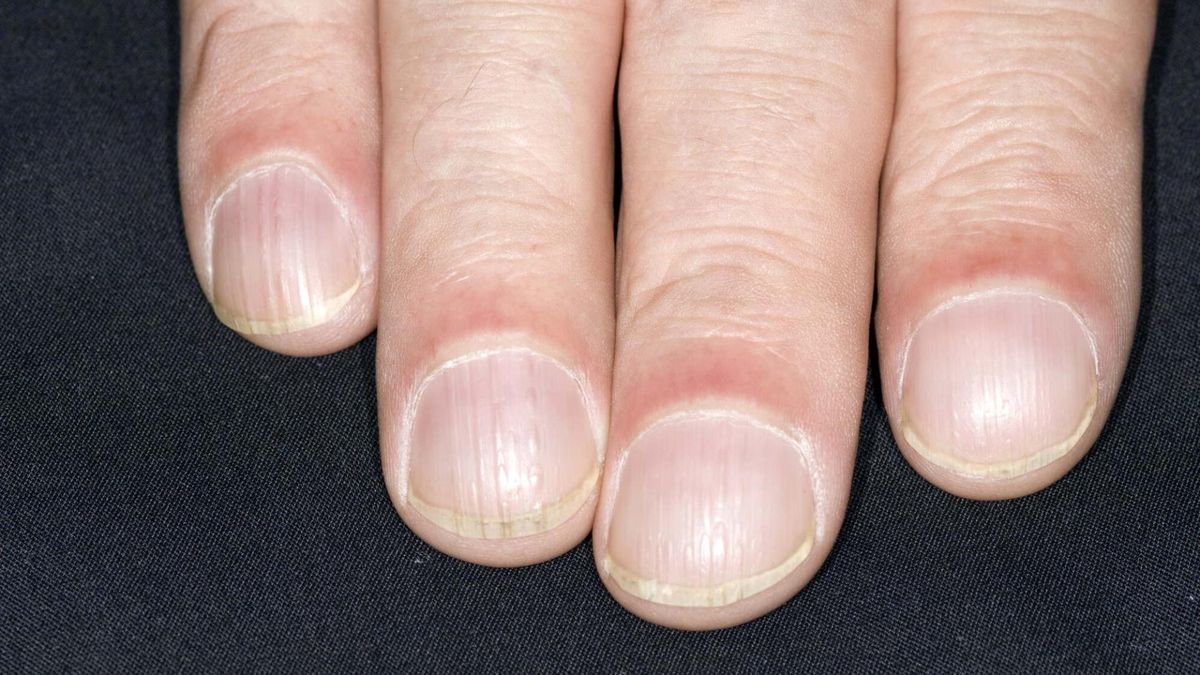 Nie bagatelizuj tych objawów, jeżeli zauważysz je u siebie