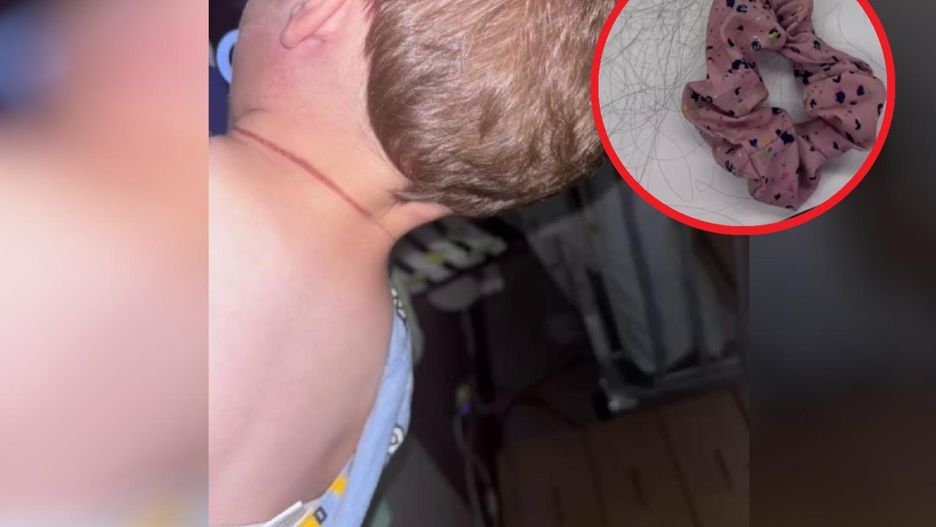 Położyła się z dzieckiem. Rano zobaczyła ślady na jego szyi