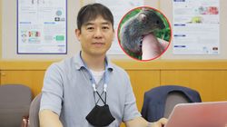 Naukowcy zatrzymali progerię. Nowa nadzieja dla pacjentów 