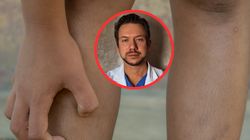 Tak objawia się cukrzyca na ciele. Lekarz pokazał zdjęcia