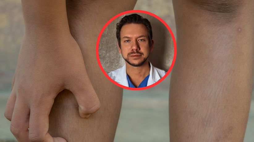 Zauważysz, gdy cukrzyca wymyka się spod kontroli. Pojawia się na skórze