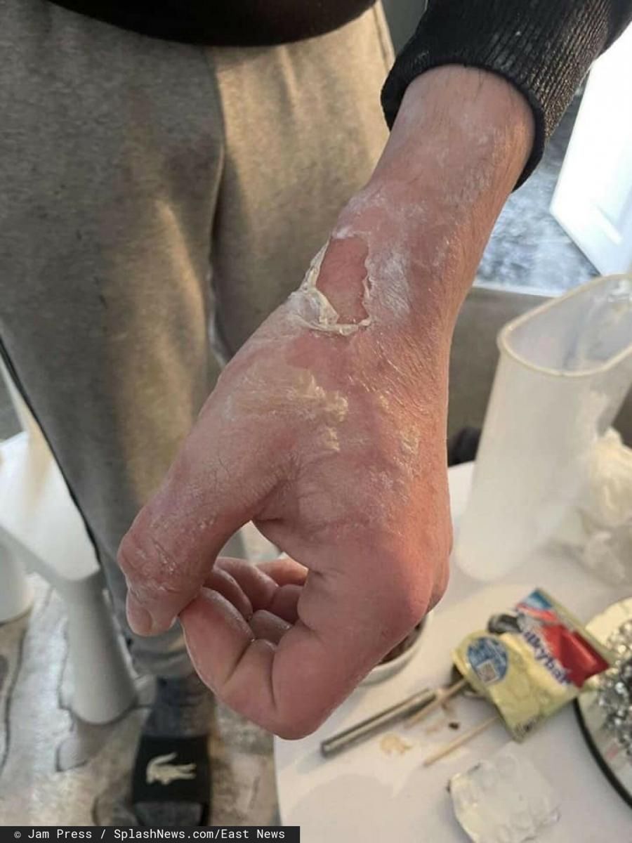 Ręka męża Shannon