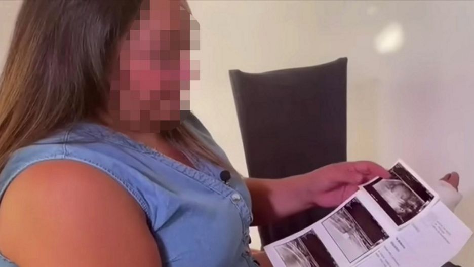 7-latka z rakiem piersi. Jest najmłodszą pacjentką