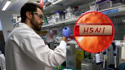 Szereg obostrzeń na Dolnym Śląsku. Wykryto wysoce zjadliwego wirusa