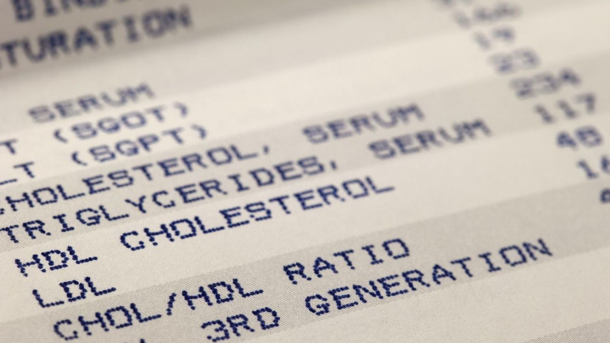 Dobry cholesterol ma pozytywny wpływ na zdrowie.