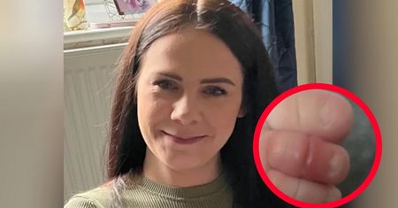Mama ostrzega przed popularnym błędem. Dziecko prawie straciło palce