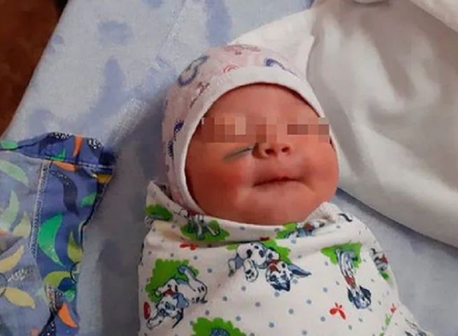 Lekarze przecięli twarz dziecka podczas porodu