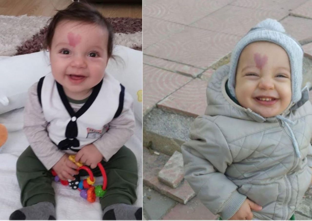 Chłopiec ze znamieniem w kształcie serca na czole ma już 5 lat. Jak wygląda?