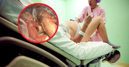 Niezwykłe narodziny w Warszawie. Bliźnięta mają różny kolor skóry