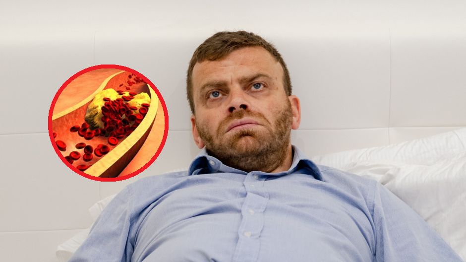 Przewlekły stres ma wpływ na poziom cholesterolu. Lista dolegliwości jest naprawdę długa