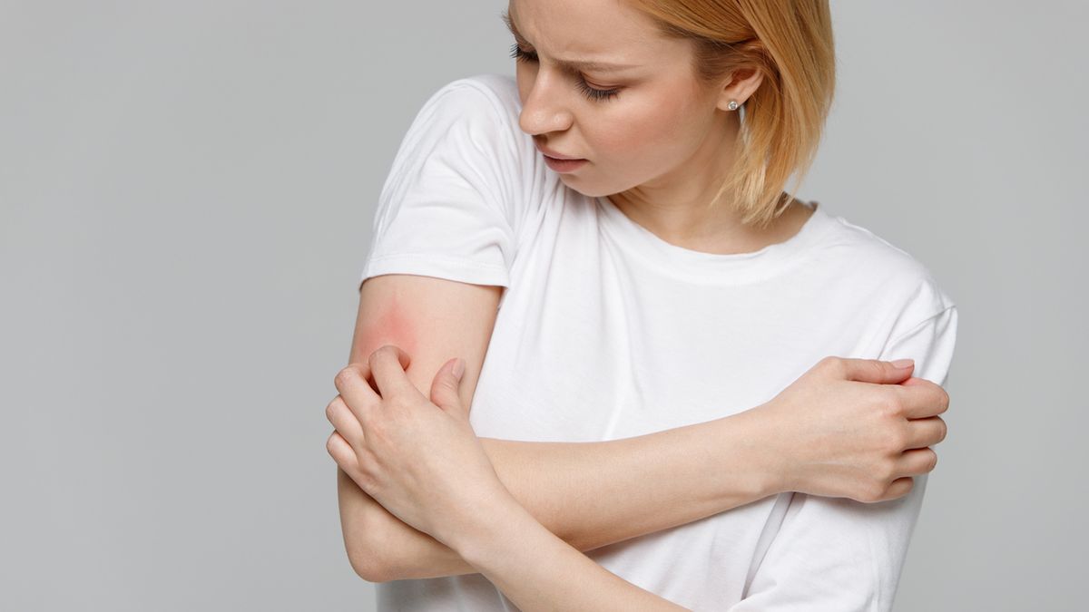 Zespół Sézary’ego powoduje zaczerwienienie i swędzenie skóry.