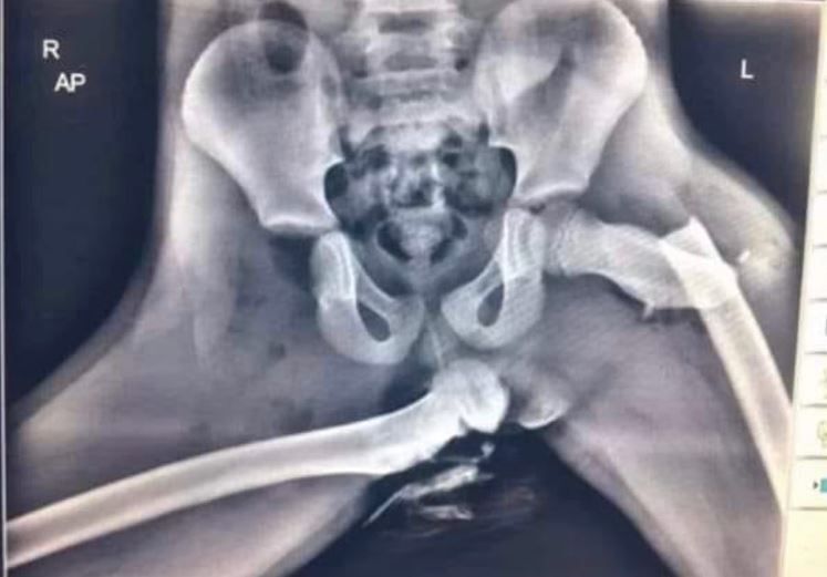 Zdjęcie ku przestrodze 