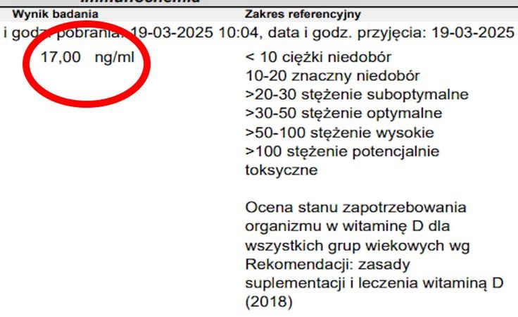 Poważny niedobór witaminy D