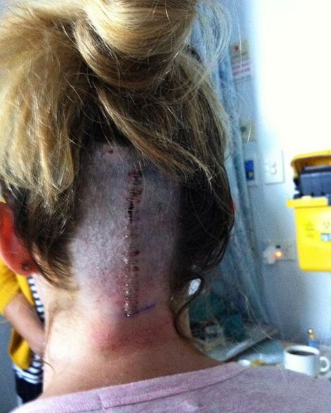 Amy Pejkovic przeszła operację usunięcia guza mózgu