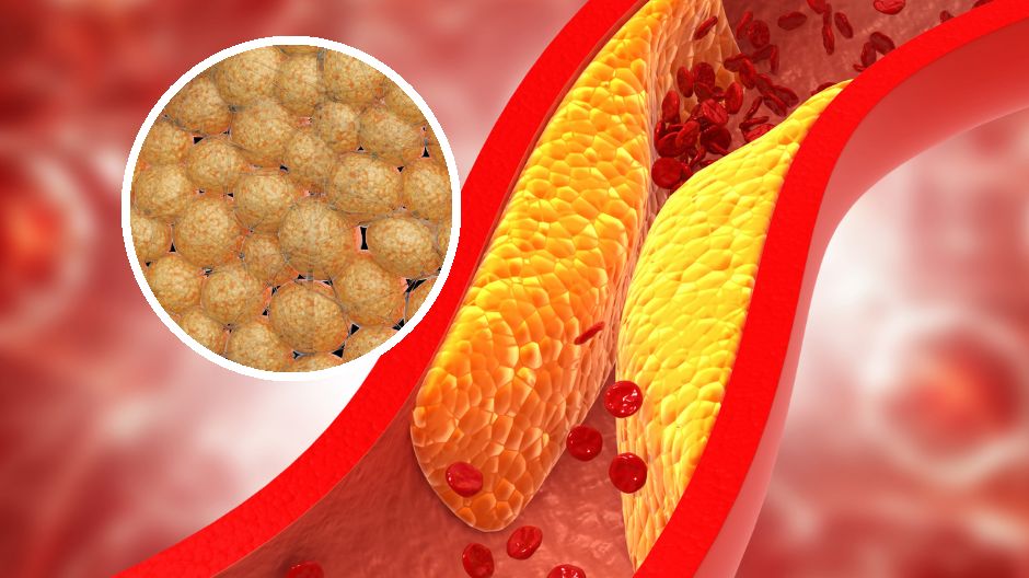 Podwyższony poziom cholesterolu ma negatywny wpływ na nasze zdrowie