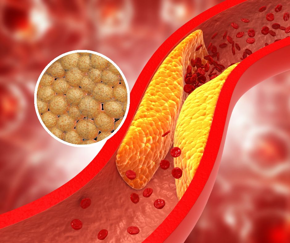 "Paliwo" dla raka. Umożliwia komórkom nowotworowym przetrwanie