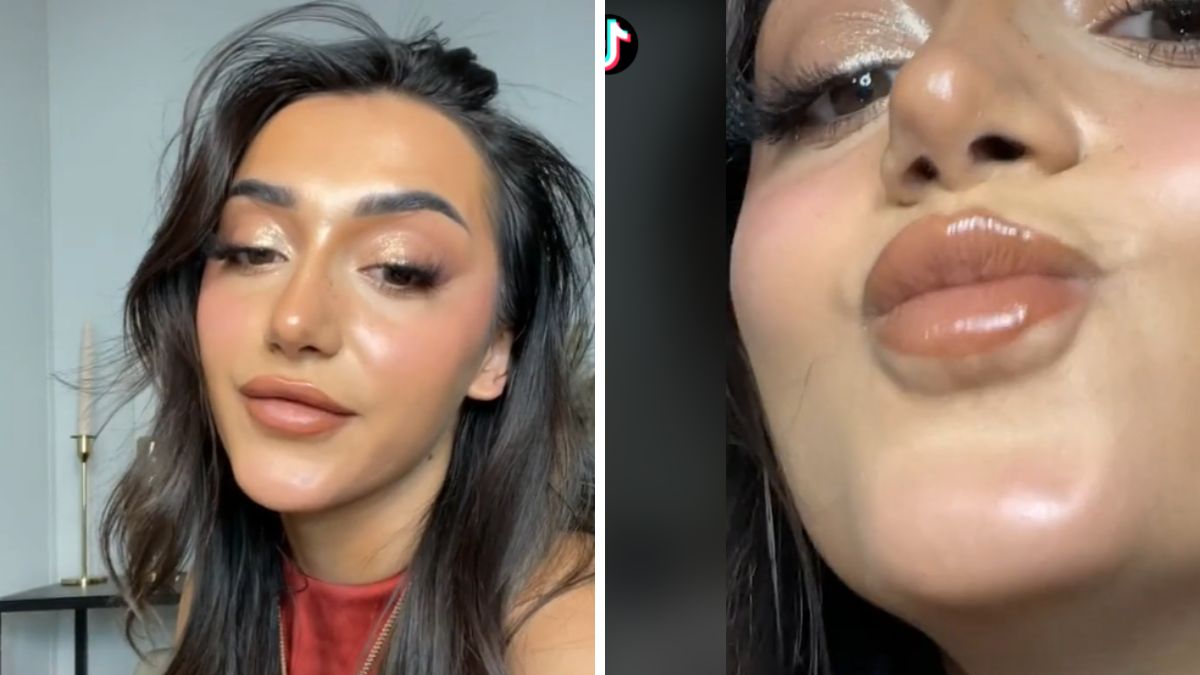 Pokazała skutek powiększania ust. Internauci oburzeni: "Przestań przekonywać młode kobiety, by się na to decydowały"