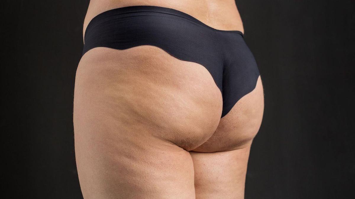 Ćwiczenia na cellulit, które naprawdę działają to przede wszystkim ćwiczenia kardio i ćwiczenia siłowe