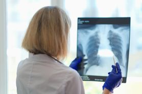 Ropień płucny - rodzaje, przyczyny, objawy, diagnostyka i leczenie