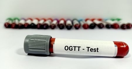 OGTT – badanie, wskazania, interpretacja