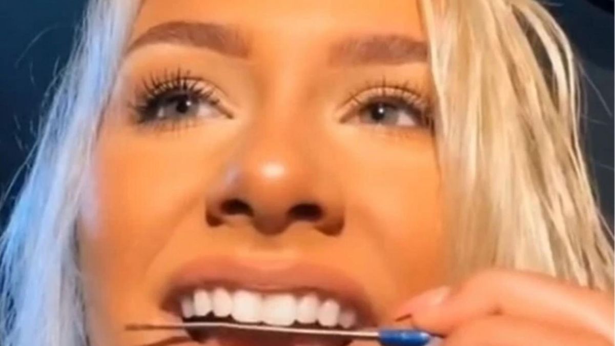 Kolejny niebezpieczny trend na TikToku. Piłują zęby pilnikiem do paznokci, aby je wyrównać