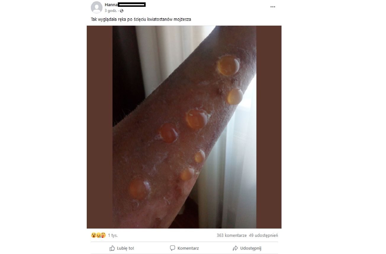 Tak się może skończyć bliski kontakt z krzewem Mojżesza