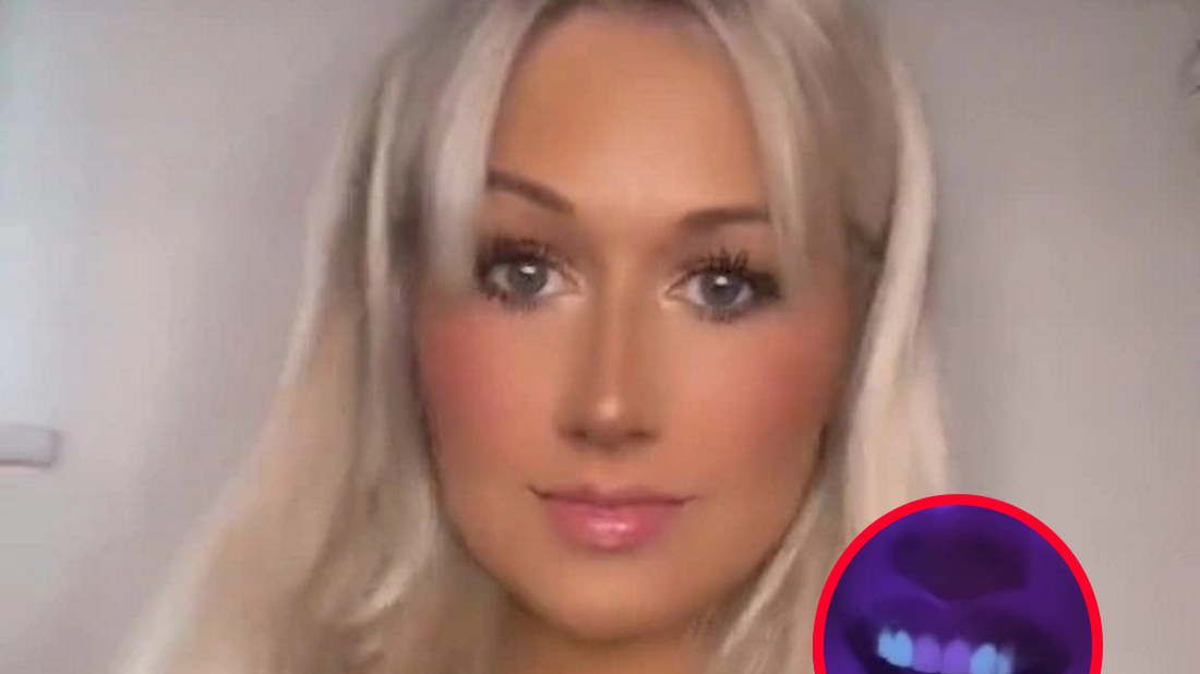 Popłakała się ze śmiechu, gdy zorientowała się w klubie jak wyglądają jej licówki