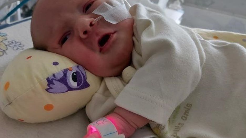 Lilianka Nowakowska walczy o życie. Dziewczynka urodziła się z poważną wadą serca i przepony