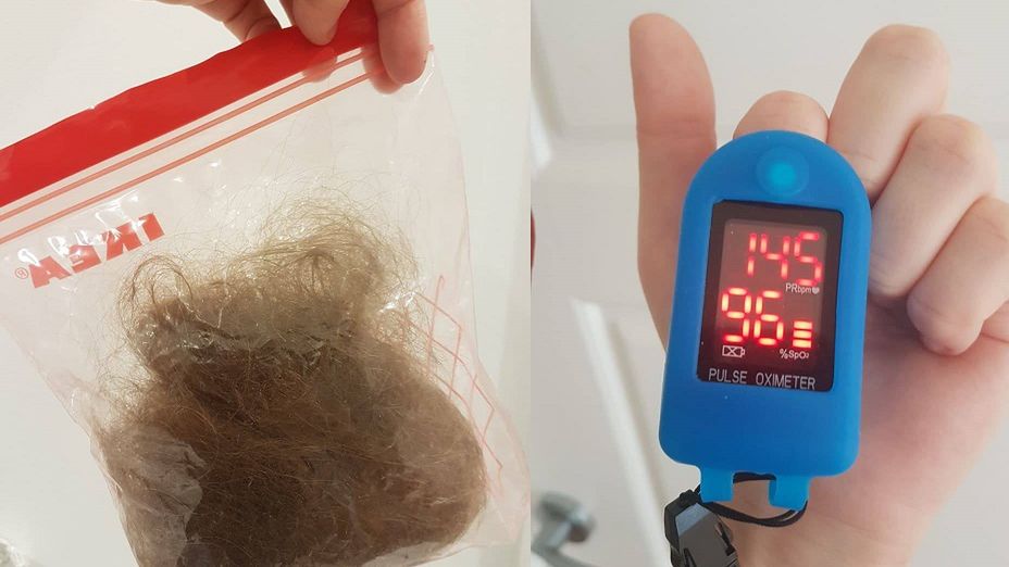 Powikłania po COVID-19