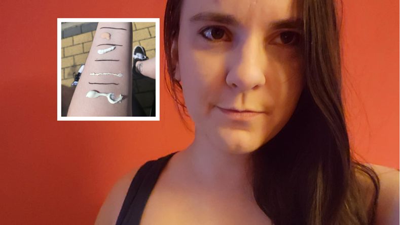 Wystarczy kilka minut na słońcu, by doszło do poparzeń. Sprawdziłam to na własnej skórze