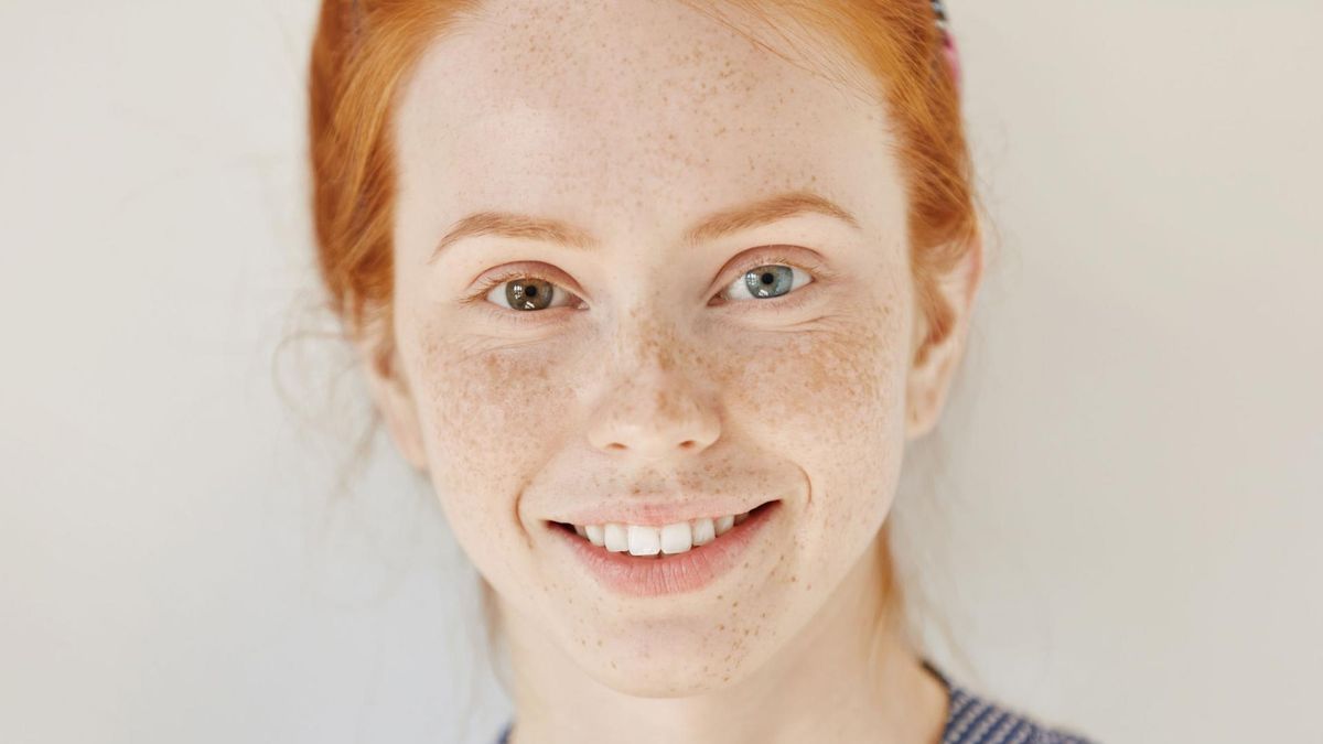 Heterochromia iridis, czyli różnobarwność tęczówek, może być tylko naszym znakiem szczególnym, a nie oznaką choroby.