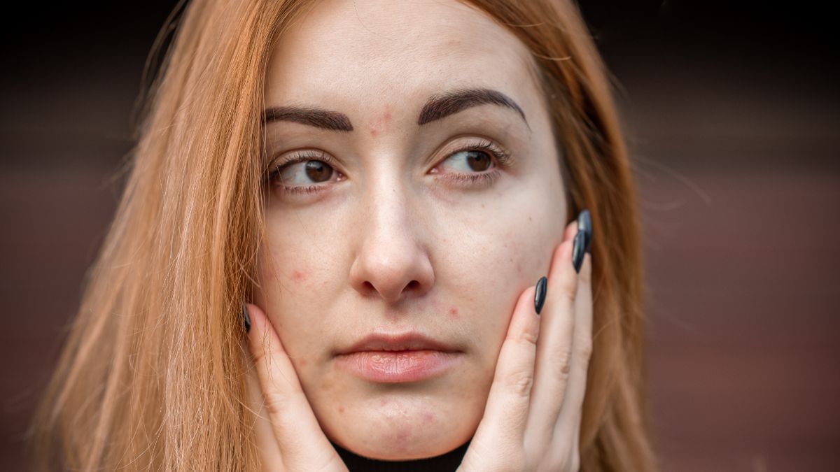 Gruczoły łojowe są mikroskopijnymi gruczołami skórnymi, które produkują sebum.