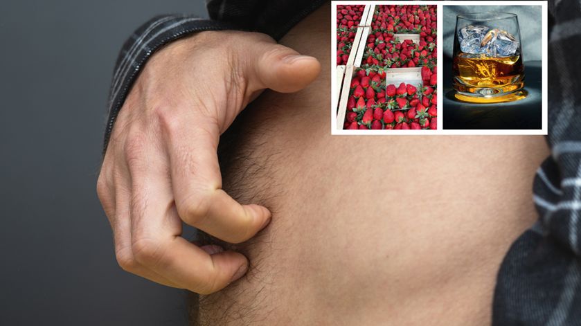 Wirusowe zapalenie wątroby może być groźne dla życia