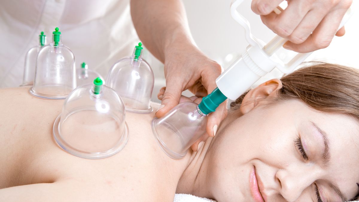 Stawianie baniek to metoda leczenia, którą praktykowano już wiele lat temu.