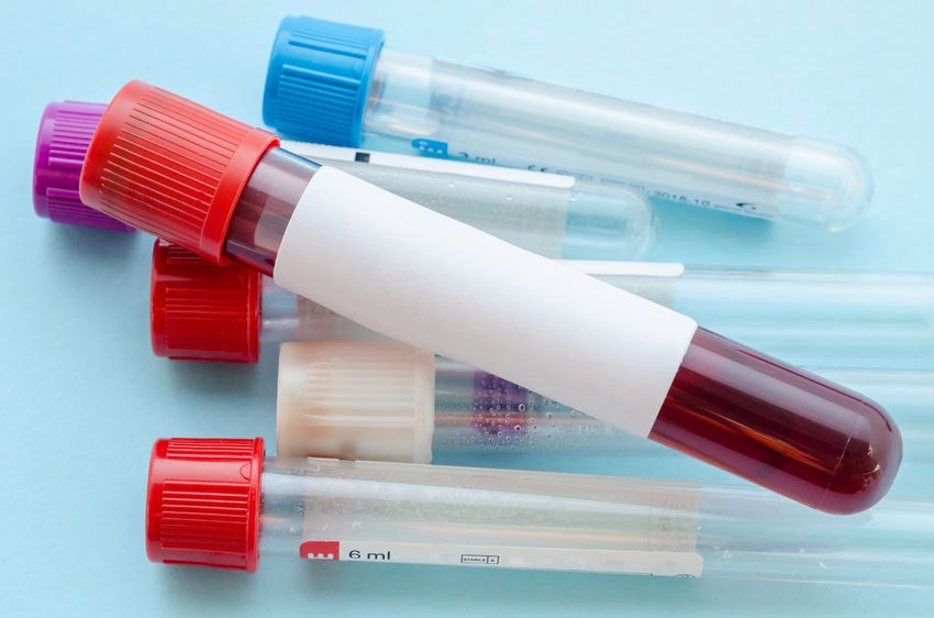 Sport podnosi poziom dobrego cholesterolu