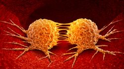 Kancerogeneza - czym jest i jak z nią walczyć